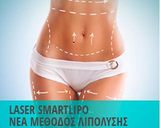 Smart Lipo λιποαναρρόφηση